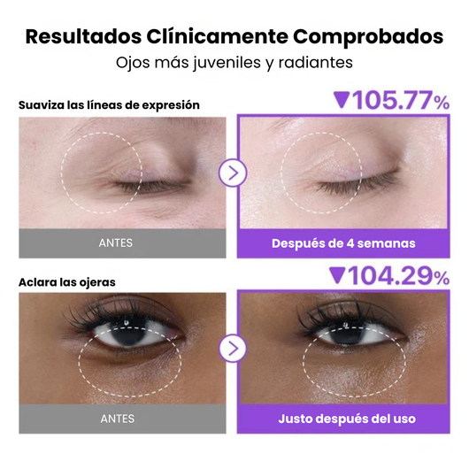 Crema de ojos Volumetox con NAD⁺ y Retinol Nº 9